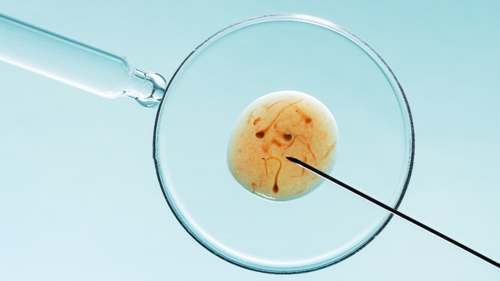 Intracytoplasmic Sperm Injection (ICSI): Comprehensive Treatment Guide in Chennai