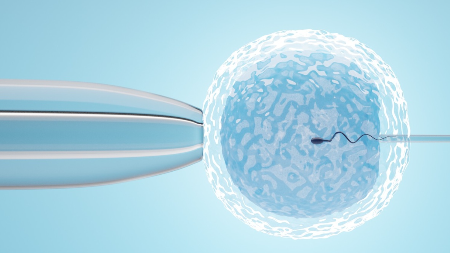 IUI (2)