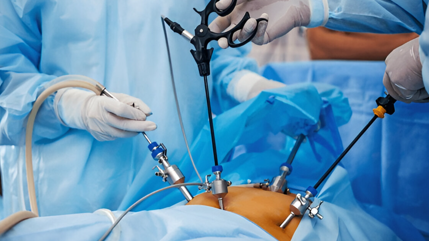 Laproscopic Surgery